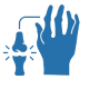 Rheumatoid Arthritis